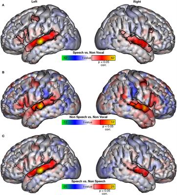 The Temporal Voice Areas are not “just” Speech Areas